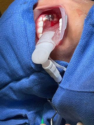 Isolite Operating Room Adapter (ORA)