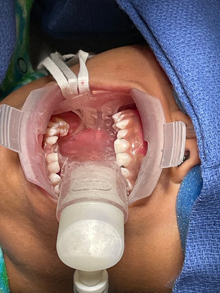 Isolite Operating Room Adapter (ORA)