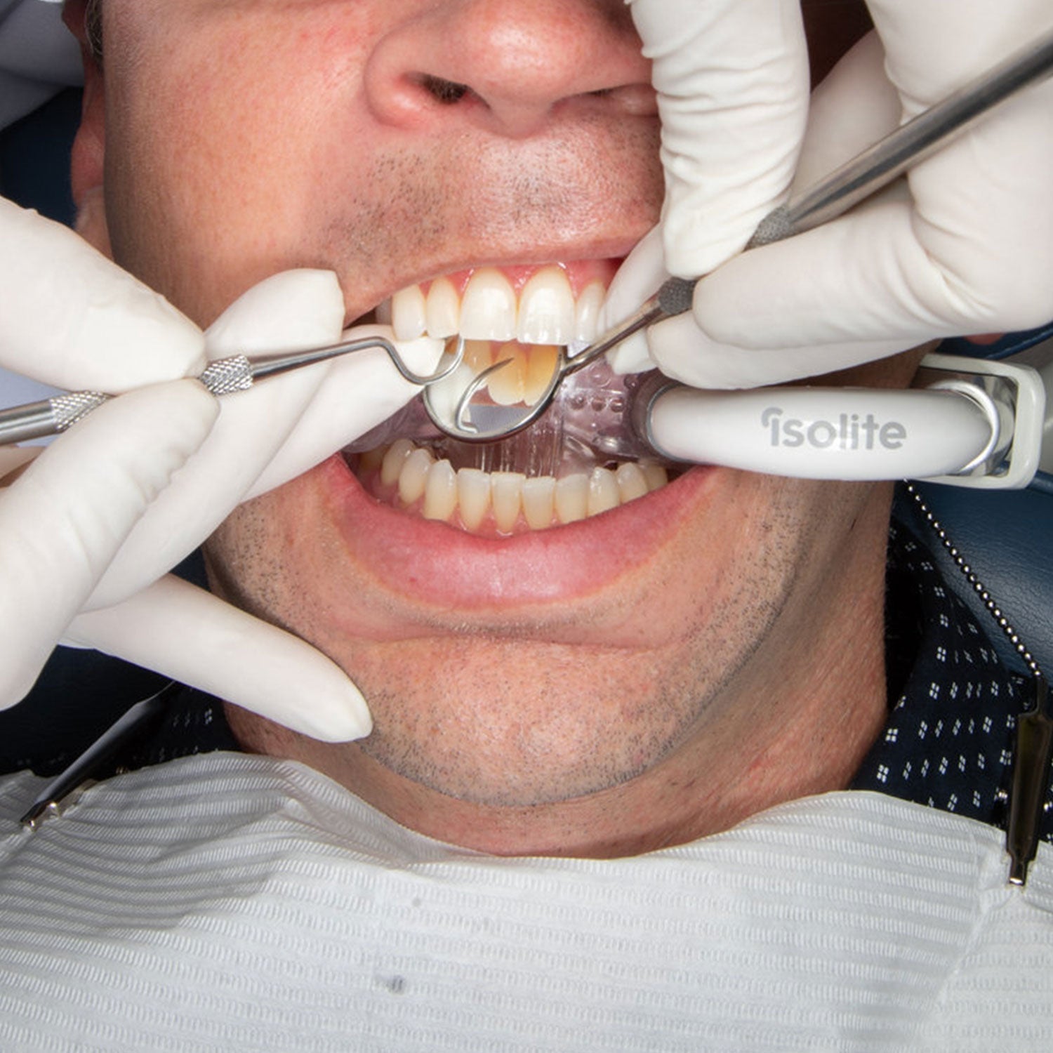 Zyris Isolite Core System with Anterior mouthpiece, male patient.