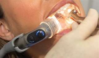 Dental Nachos Isolite® Bundle